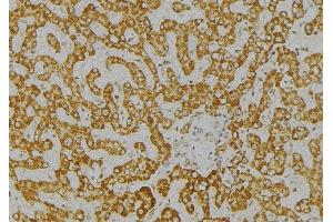 ABIN6276621 at 1/100 staining Mouse liver tissue by IHC-P. (ITPA antibody  (Internal Region))
