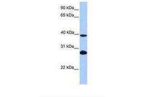 Image no. 1 for anti-Ubiquitin-Conjugating Enzyme E2F (UBE2F) (N-Term) antibody (ABIN6738837) (UBE2F antibody  (N-Term))
