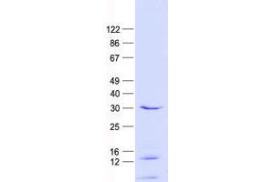 Validation with Western Blot