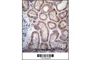 SP140 Antibody immunohistochemistry analysis in formalin fixed and paraffin embedded human kidney tissue followed by peroxidase conjugation of the secondary antibody and DAB staining. (SP140 antibody  (AA 272-301))
