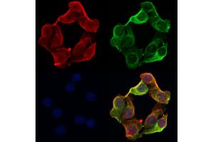 ABIN6263783 and ABIN6266750 staining Hela by IF/ICC. (NXF1 antibody  (N-Term))
