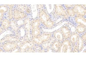 Detection of LOX1 in Human Kidney Tissue using Polyclonal Antibody to Lectin Like Oxidized Low Density Lipoprotein Receptor 1 (LOX1) (OLR1 antibody  (AA 81-273))