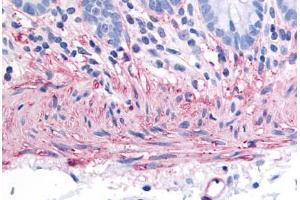Human Colon, Smooth Muscle (formalin-fixed, paraffin-embedded) stained with TACR2 antibody ABIN213476 at 40 ug/ml followed by biotinylated goat anti-rabbit IgG secondary antibody ABIN481713, alkaline phosphatase-streptavidin and chromogen. (TACR2 antibody  (C-Term))