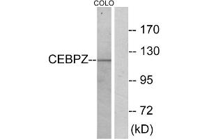 Western blot analysis of extracts from COLO cells, using C/EBP zeta antibody. (DDIT3 antibody  (N-Term))