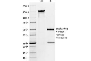 SDS-PAGE Analysis Purified CD86 Mouse Monoclonal Antibody (BU63). (CD86 antibody)