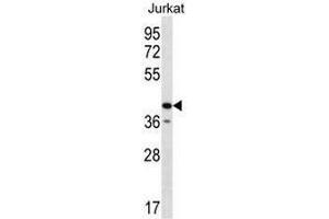 GORASP2 Antibody (Center) western blot analysis in Jurkat cell line lysates (35µg/lane). (GORASP2 antibody  (Middle Region))