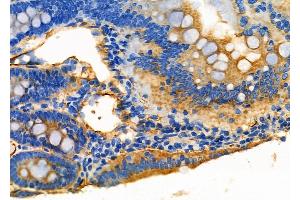 ABIN6266210 and ABIN6277363 at 1/100 staining Rat colorectal tissue by IHC-P.