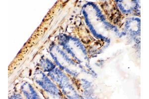 Galectin 1 was detected in paraffin-embedded sections of mouse intestine cancer tissues using rabbit anti- Galectin 1 Antigen Affinity purified polyclonal antibody (Catalog # ) at 1 ? (LGALS1/Galectin 1 antibody  (AA 2-135))