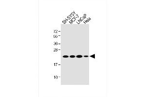 All lanes : Anti-RK7 Antibody (C-term) at 1:2000 dilution Lane 1: SH-SY5Y whole cell lysate Lane 2: MCF-7 whole cell lysate Lane 3: LNCaP whole cell lysate Lane 4: Hela whole cell lysate Lysates/proteins at 20 μg per lane. (PARK7/DJ1 antibody  (C-Term))