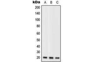 Western blot analysis of RPL11 expression in Jurkat (A), mouse liver (B), H9C2 (C) whole cell lysates. (RPL11 antibody  (C-Term))