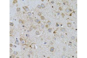 Immunohistochemistry of paraffin-embedded Mouse brain using NAT8 Polyclonal Antibody (NAT8 antibody)