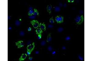 Anti-ACO2 mouse monoclonal antibody (ABIN2452696) immunofluorescent staining of COS7 cells transiently transfected by pCMV6-ENTRY ACO2 (RC204307). (ACO2 antibody)