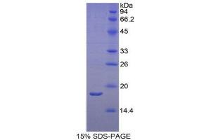SDS-PAGE (SDS) image for Retinol Binding Protein 2, Cellular (RBP2) (AA 1-134) protein (His tag) (ABIN2122013)