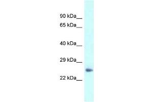 WB Suggested Anti-Dpt Antibody   Titration: 1. (Dermatopontin antibody  (N-Term))