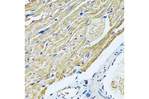 Immunohistochemistry of paraffin-embedded mouse heart using SLC5A6 antibody (ABIN6292573) at dilution of 1:100 (40x lens). (SLC5A6 antibody)