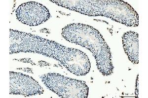 IHC analysis of MCM6 using anti-MCM6 antibody (ABIN7600038). (MCM6 antibody  (AA 14-821))