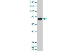 SLC27A5 polyclonal antibody (A01), Lot # 060703JCS1. (SLC27A5 antibody  (AA 90-175))