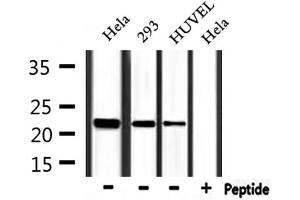 Western blot analysis of extracts from Hela,293 and HUVEC, using FTH1 Antibody. (FTH1 antibody  (C-Term))