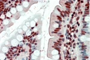 Immunohistochemistry (IHC) image for anti-Ewing Sarcoma Breakpoint Region 1 (EWSR1) antibody (ABIN5864986) (EWSR1 antibody)