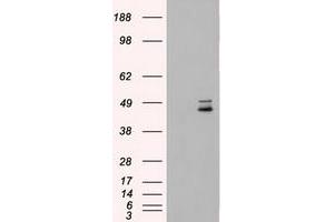 HEK293T cells were transfected with the pCMV6-ENTRY control (Left lane) or pCMV6-ENTRY MAP2K4 (Right lane) cDNA for 48 hrs and lysed. (MAP2K4 antibody)