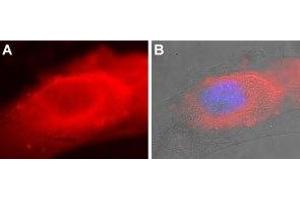 Expression of SERCA2 in mouse C2C12 cells - Immunocytochemical staining of fixed and permeabilized mouse myoblast C2C12 cells. (ATP2A2 antibody  (AA 498-510))