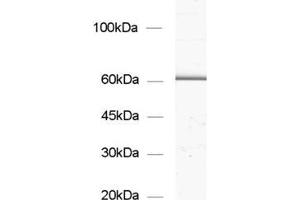 dilution: 1 : 1000, sample: synaptic vesicle fraction of rat brain (LP2) (GAD65 antibody  (AA 3-96))