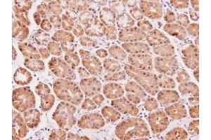 IHC-P Image Immunohistochemical analysis of paraffin-embedded human lung SCC, using DAK, antibody at 1:100 dilution. (DAK antibody  (Center))