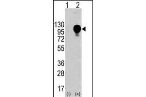 Western blot analysis of LP2 (arrow) using LP2 Antibody (Center) (ABIN388569 and ABIN2849749). (LAMP2 antibody  (AA 196-225))