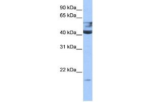 WB Suggested Anti-QTRT1 Antibody Titration:  0.
