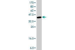 Western Blot detection against Immunogen (37 KDa) . (CORO1C antibody  (AA 375-473))