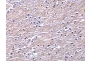 Immunohistochemistry of Clusterin in human brain tissue with Clusterin antibody at 10 μg/ml.