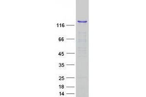 Western Blotting (WB) image for Splicing Factor 3b, Subunit 2, 145kDa (SF3B2) protein (Myc-DYKDDDDK Tag) (ABIN2732607)