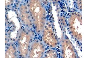 Detection of HIF1a in Human Cardiac Muscle Tissue using Polyclonal Antibody to Hypoxia Inducible Factor 1 Alpha (HIF1a) (HIF1A antibody  (AA 575-826))