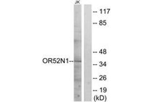 Western blot analysis of extracts from Jurkat cells, using OR52N1 Antibody. (OR52N1 antibody  (AA 269-318))
