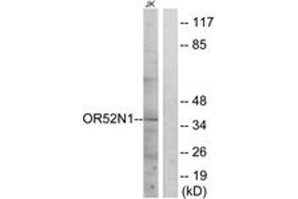 OR52N1 抗体  (AA 269-318)