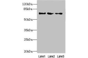 Western blot All lanes: PPIL4 antibody at 4 μg/mL Lane 1: Hela whole cell lysate Lane 2: Mouse kidney tissue Lane 3: HepG2 whole cell lysate Secondary Goat polyclonal to rabbit IgG at 1/10000 dilution Predicted band size: 58 kDa Observed band size: 70 kDa