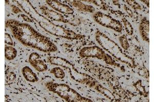 ABIN6278352 at 1/100 staining Human kidney tissue by IHC-P.