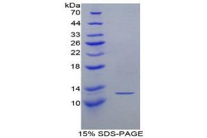 SDS-PAGE (SDS) image for Chemokine (C Motif) Ligand 1 (XCL1) (AA 26-111) protein (His tag,T7 tag) (ABIN1879854) (XCL1 Protein (AA 26-111) (His tag,T7 tag))