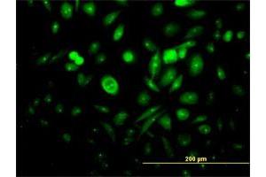 Immunofluorescence of purified MaxPab antibody to FGFR1OP on HeLa cell. (FGFR1OP antibody  (AA 1-399))
