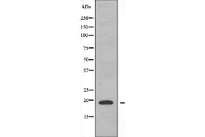 Western blot analysis of extracts from A549 cells, using Histone 1F0 antibody.