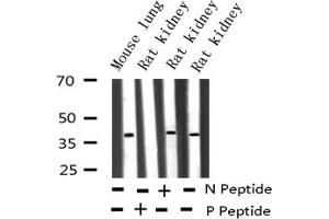 Western blot analysis of Phospho-c-Jun (Tyr170) expression in various lysates (C-JUN antibody  (pTyr170))
