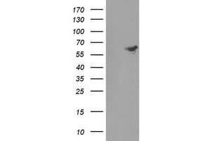Western Blotting (WB) image for anti-Formiminotransferase Cyclodeaminase (FTCD) antibody (ABIN1496382) (FTCD antibody)