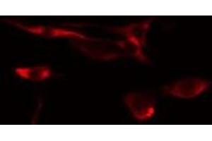 ABIN6275441 staining  NIH-3T3 cells by IF/ICC. (RFTN1 antibody  (Internal Region))