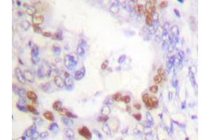Image no. 1 for anti-Fanconi Anemia, Complementation Group D2 (FANCD2) antibody (ABIN265413) (FANCD2 antibody)