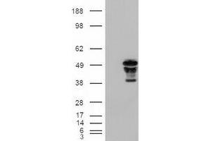 HEK293T cells were transfected with the pCMV6-ENTRY control (Left lane) or pCMV6-ENTRY FOXA2 (RC211408) (Right lane) cDNA for 48 hrs and lysed. (FOXA2 antibody  (AA 300-458))