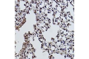 Immunohistochemistry of paraffin-embedded mouse lung using MonoMethyl-Histone H3-K9 antibody (ABIN7267685) at dilution of 1:100 (40x lens). (Histone 3 antibody  (H3K9me))
