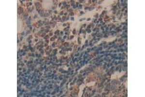 Figure. (SH3BGRL antibody  (AA 1-114))