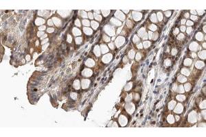ABIN6267378 at 1/100 staining Rat colon tissue by IHC-P. (NCF1 antibody  (pSer359))