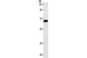 Gel: 10 % SDS-PAGE, Lysate: 40 μg, Lane: Mouse liver tissue, Primary antibody: ABIN7192428(SLC22A3 Antibody) at dilution 1/400, Secondary antibody: Goat anti rabbit IgG at 1/8000 dilution, Exposure time: 1 minute