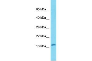 Host: Rabbit Target Name: DEFB119 Sample Type: Fetal Heart lysates Antibody Dilution: 1. (DEFB119 antibody  (N-Term))